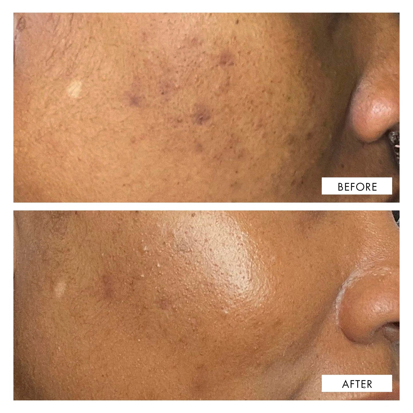 111SKIN Dark Spot Correcting Serum – Hydrating Solution for Uneven Skin Tone