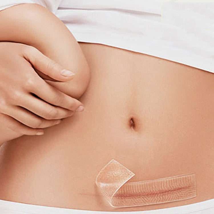 Organic silicone Gel Scar Therapy Patch be Washed and Reused