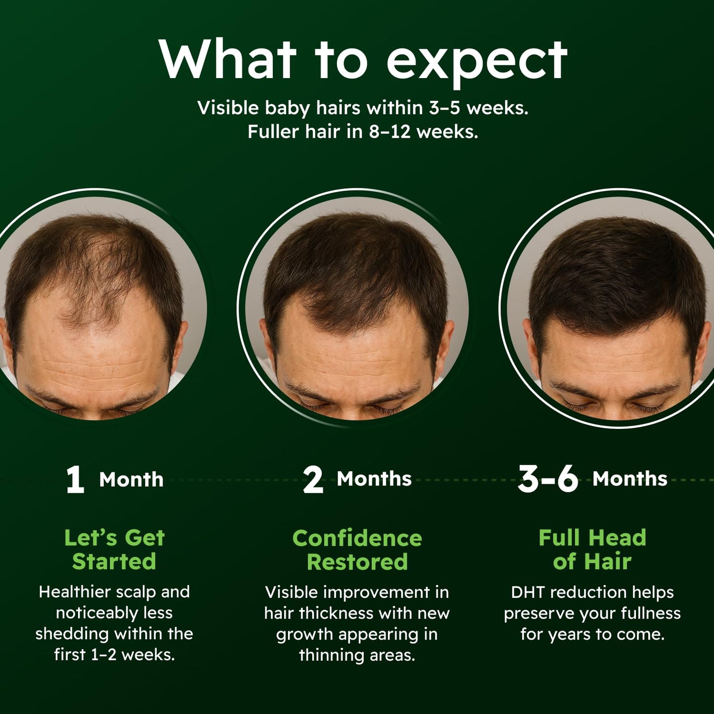 Alphainfuse Scalp Nourishing Serum for Men – Ginseng & Eclipta Botanical Blend