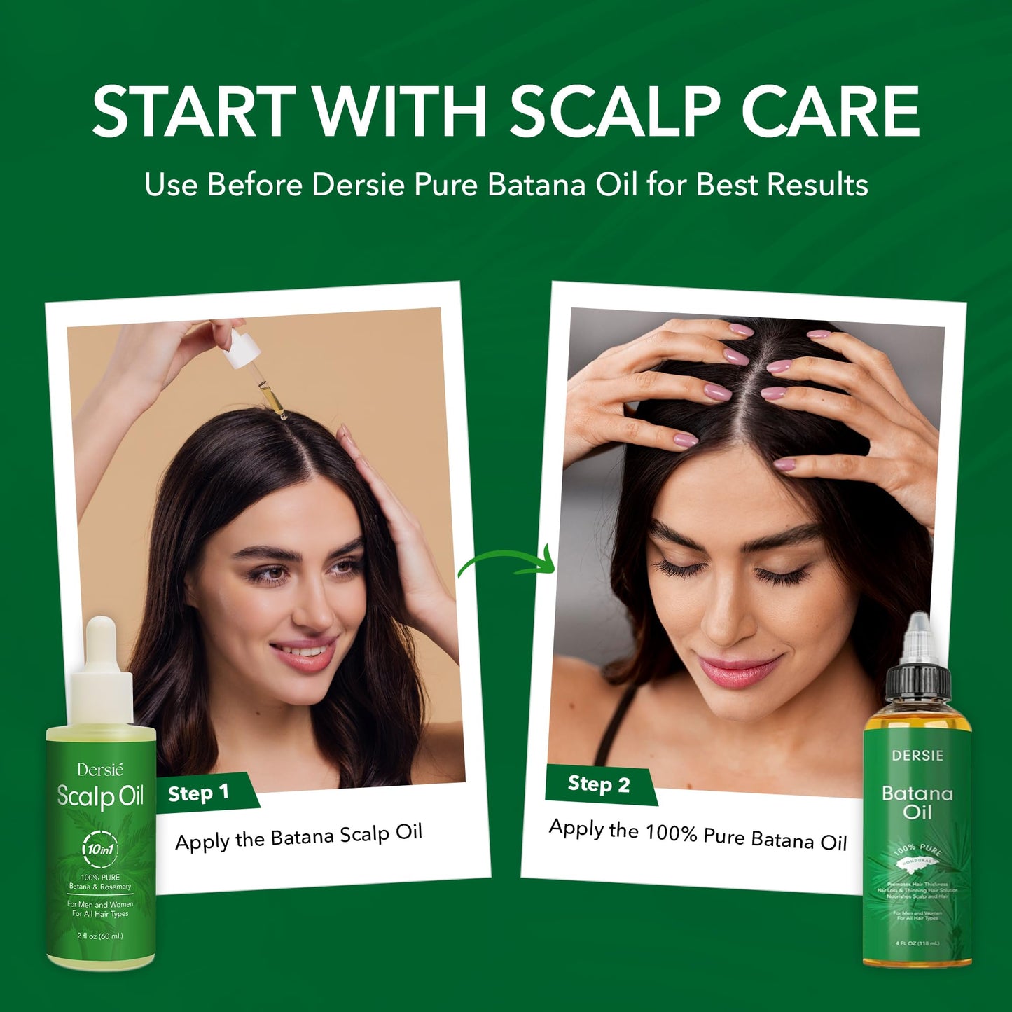 Dersie Scalp Oil for Hair Loss & Thinning Hair – Batana, Rosemary & Tea Tree (60mL)