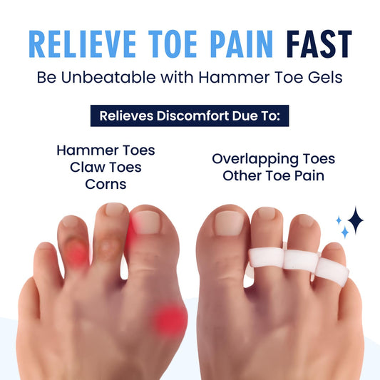 Dr. Frederick's Original Hammer Toe Corrector Gels – 2 Pairs for All-Day Toe Alignment