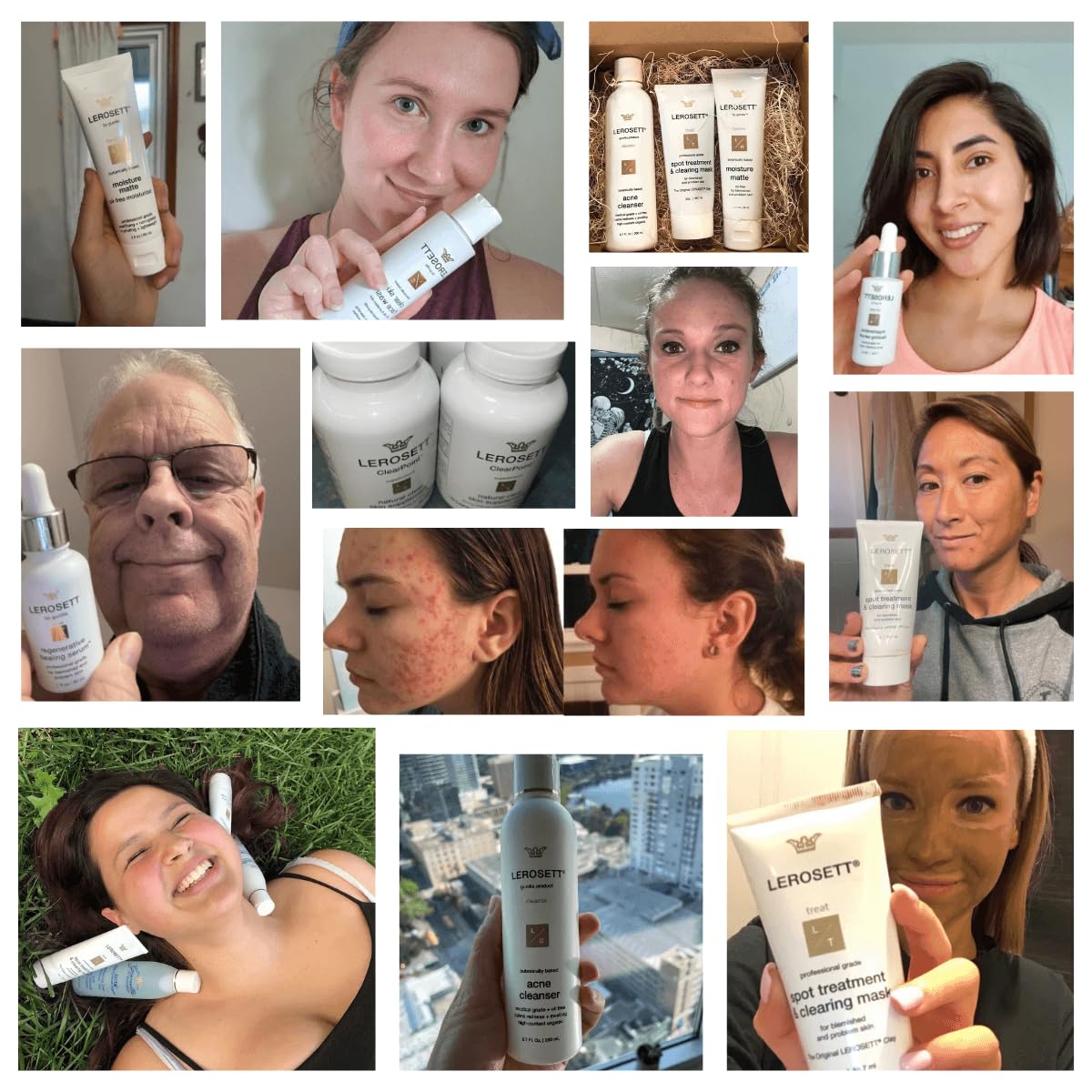 LEROSETT Acne Kit by Gunilla Of Sweden – Aloe & Clay Based, Vegan, All Skin Types