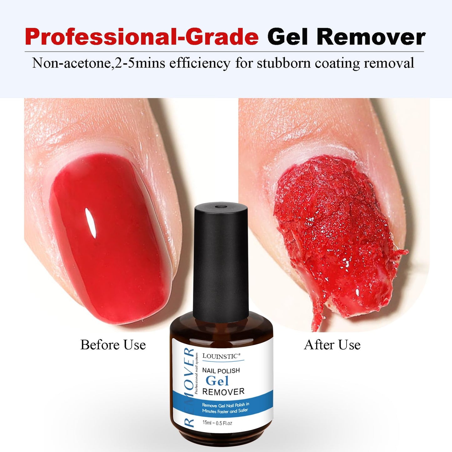 LOUINSTIC Gel Nail Polish Remover Kit – 2pcs Removers, Nail Pusher & Scraper, 2 Files, Quick 2–5 Minute Home Removal