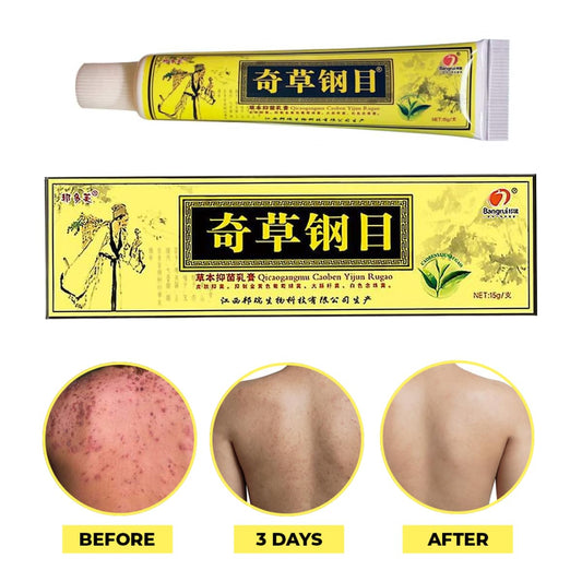 QICAOGANGMU Chinese Herbal Cream – Natural Skin Support, Pack of 3 | Official Seller
