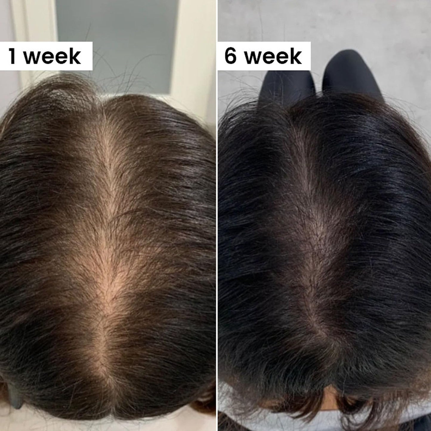 QUZOYU Thicair Hair Regrowth System – Volumizing Serum with Copper Peptides & Collagen