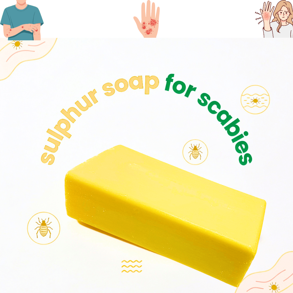 Maximum Strength 10% Sulphur Soap Bar | Handmade in Yorkshire, UK