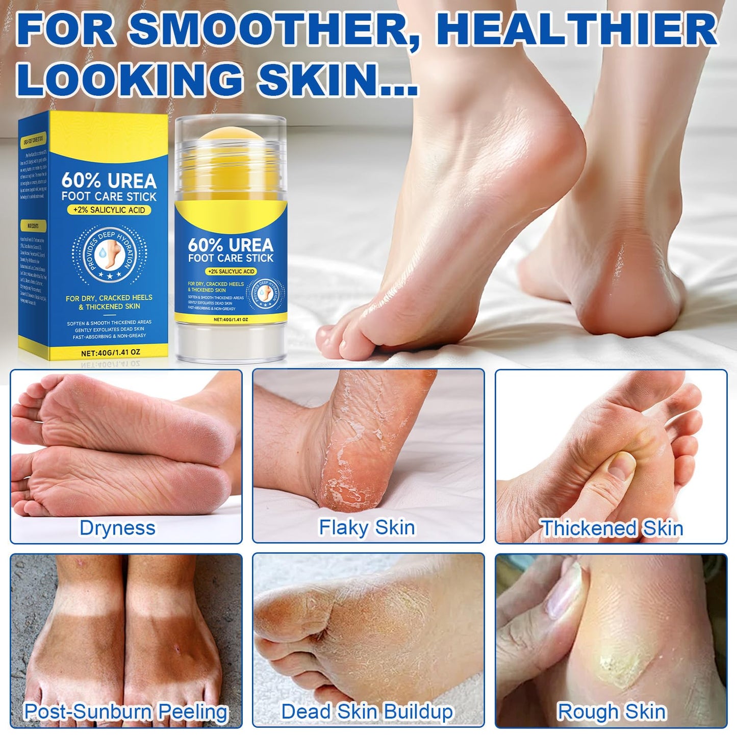 Vortexonix 60% Urea + 2% Salicylic Acid Foot Care Stick – 2-Pack for Dry Cracked Feet