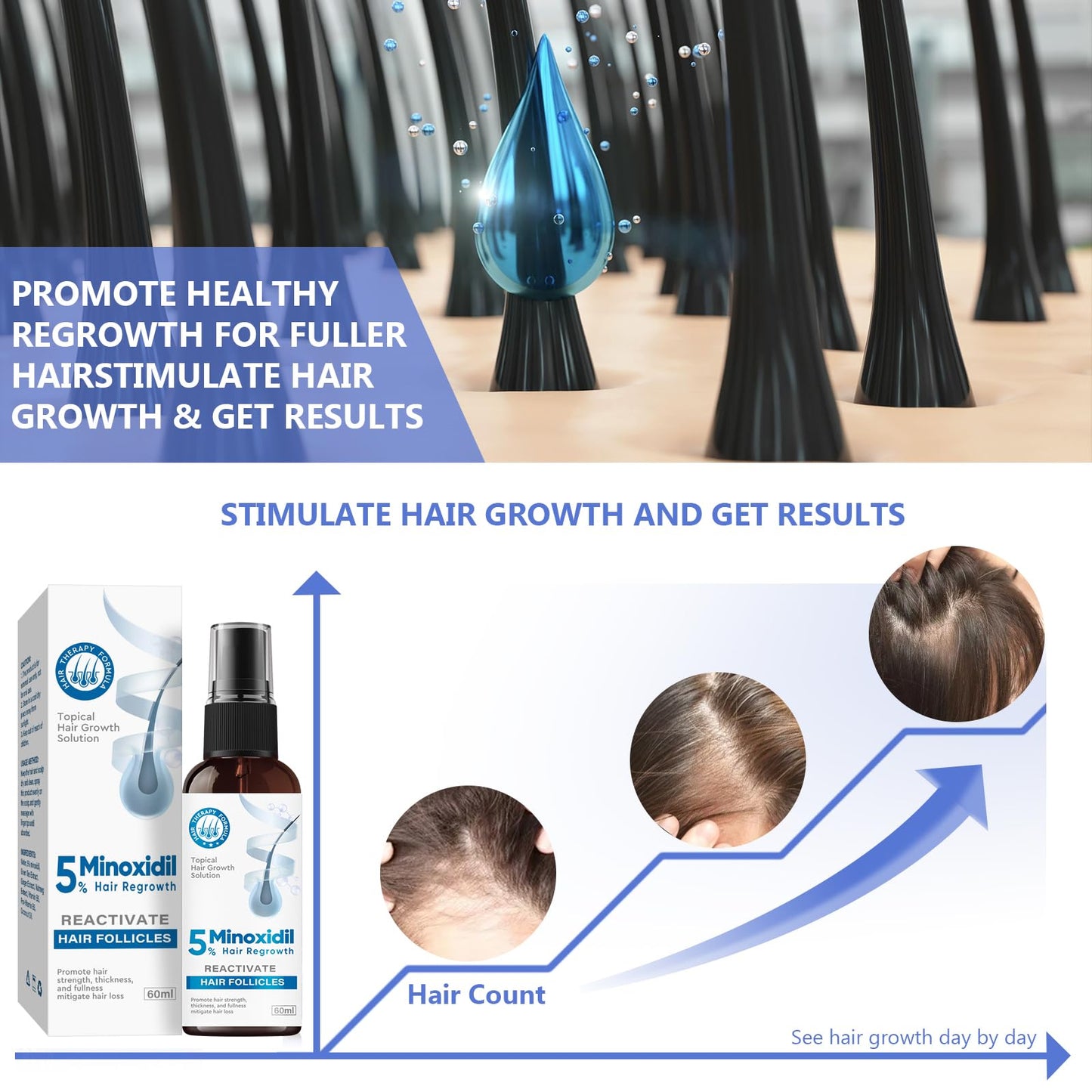 ZVBZVB Minoxidil 5% Hair Growth Spray – Thicker Hair & Beard, 60ml