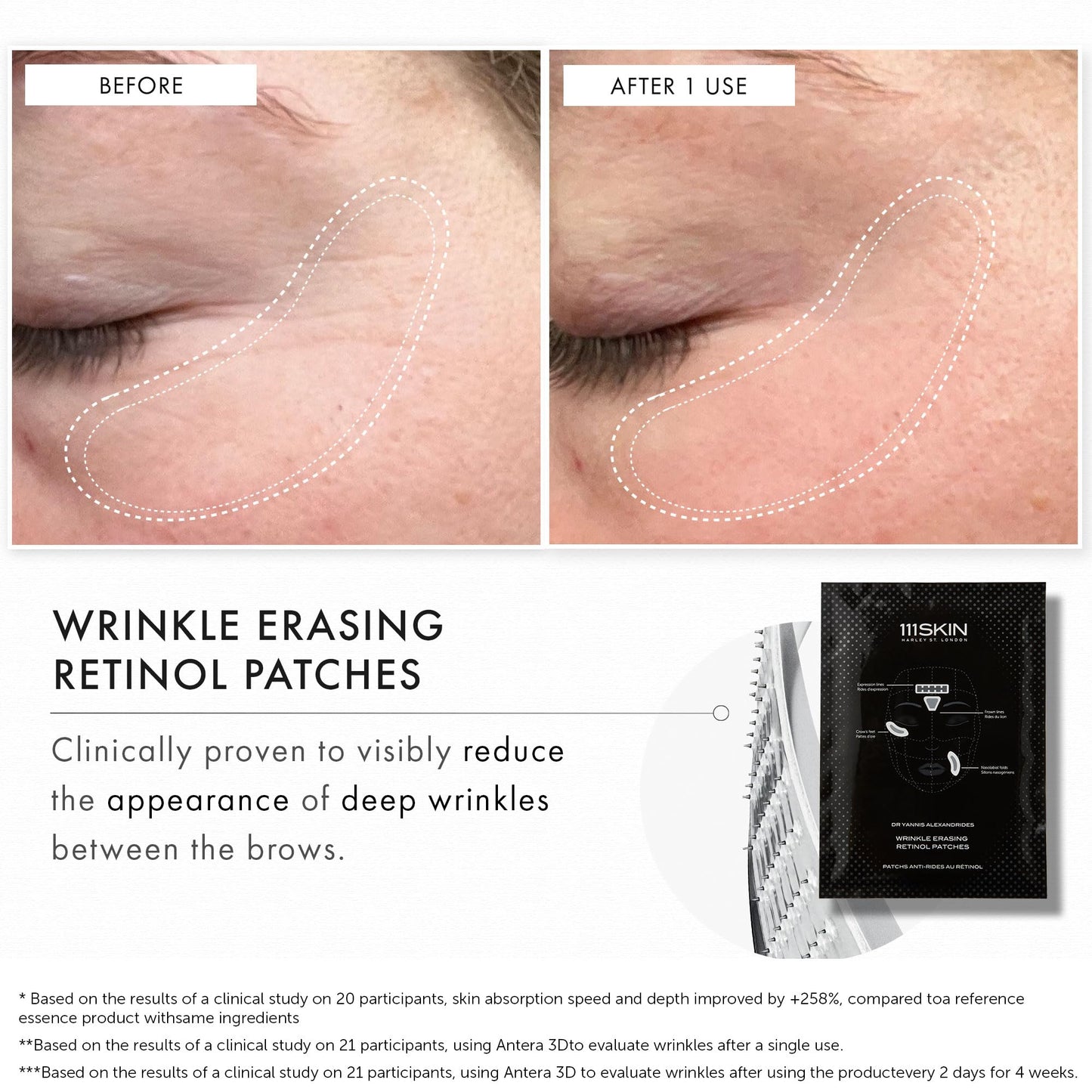 111SKIN Wrinkle Erasing Retinol Patches — Non-Invasive Forehead, Under-Eye & Smile Line, 3 x 1.23 oz