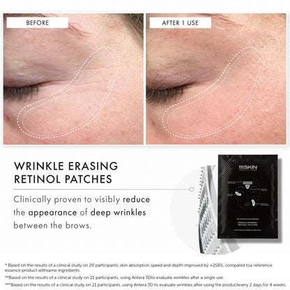 111SKIN Wrinkle Erasing Retinol Patches — Non-Invasive Forehead, Under-Eye & Smile Line, 3 x 1.23 oz
