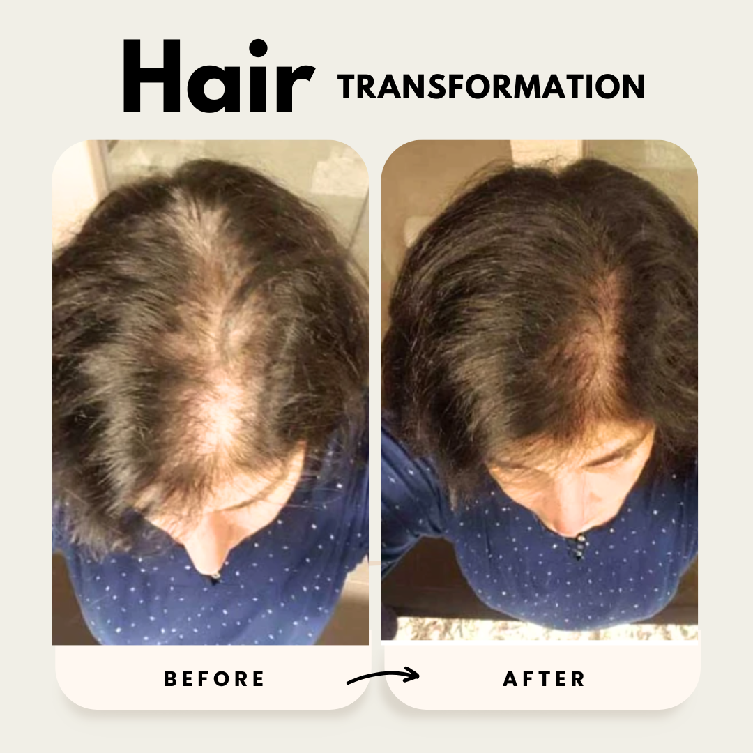 Lustrao Hair Growth Trio| Consistency Kit
