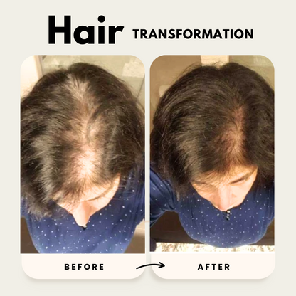 Lustrao Hair Growth Trio| Consistency Kit