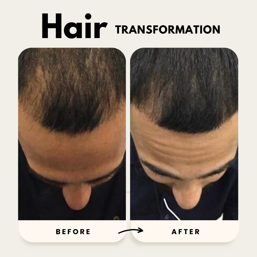 Lustrao Hair Growth Trio| Consistency Kit