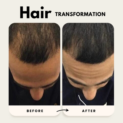 Lustrao Hair Growth Trio| Consistency Kit