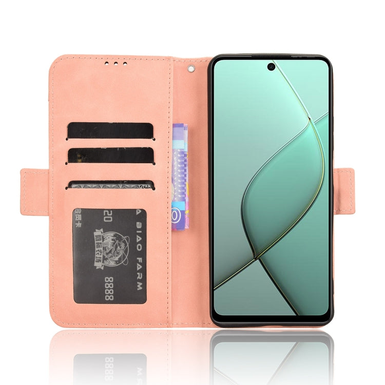 Skin Feel Calf Texture Card Slots Leather Phone Case, For Tecno Spark 20 Pro 5G, For Tecno Camon 30 Premier 5G, For Tecno Pova 6 Neo 4G, For Tecno Pova 6 4G