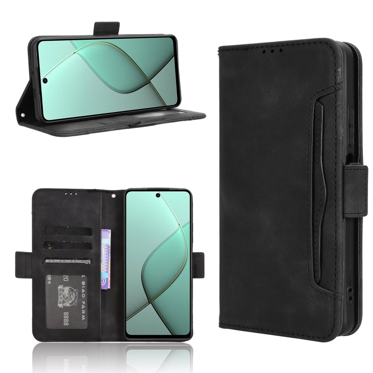Skin Feel Calf Texture Card Slots Leather Phone Case, For Tecno Spark 20 Pro 5G, For Tecno Camon 30 Premier 5G, For Tecno Pova 6 Neo 4G, For Tecno Pova 6 4G