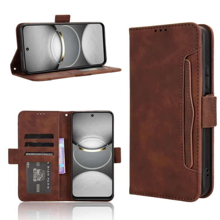 Skin Feel Calf Texture Card Slots Leather Phone Case, For Tecno Spark 30 Pro 4G, For Tecno Spark 30 4G, For Tecno Spark Go 1 / Pop 9 / Spark Go 2025, For Tecno Spark 30C 4G