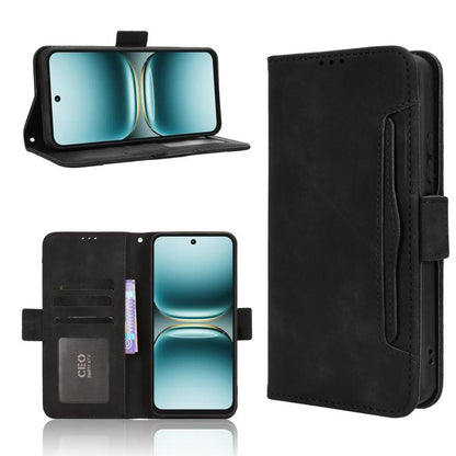 Skin Feel Calf Texture Card Slots Leather Phone Case, For Tecno Pova 7 4G, For Tecno Spark Go 2 4G, For Tecno Pova Curve 5G, For Tecno Camon 40 Pro 4G / 5G