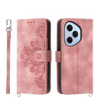 Skin Feel Flowers Embossed Wallet Leather Phone Case, For Honor X9d 5G / X70 5G, For Honor X6c 4G / X5b / X5b Plus, For Honor 400 Pro Global 160.8mm, For Honor 400 Lite Global