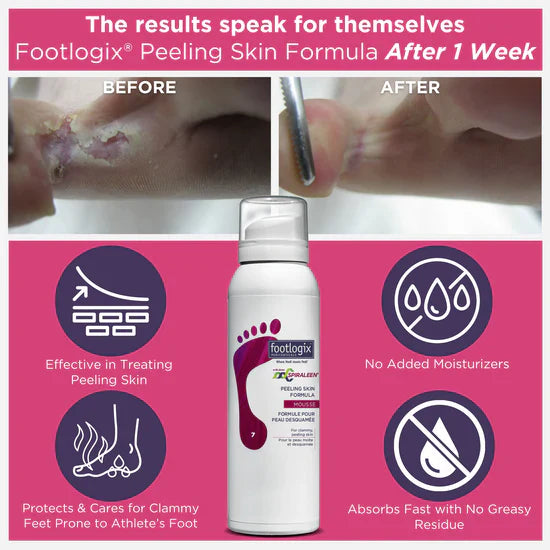 Footlogix Peeling Skin Formula (125ml)