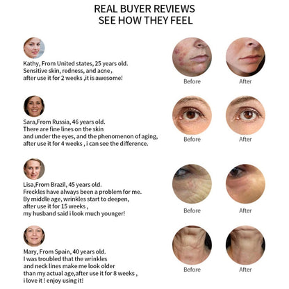 Radio Mesotherapy Electroporation Face Beauty Pen Radio Frequency LED Photon Face Skin Rejuvenation Remover Wrinkle