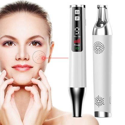 AA-A401 Small Freckle and Mole Removal Pen Tattoo and Eyebrow Removal Beauty Instrument, Red Light Plug-in, Blu-ray Plug-in, Red Light Battery, Blu-ray Battery