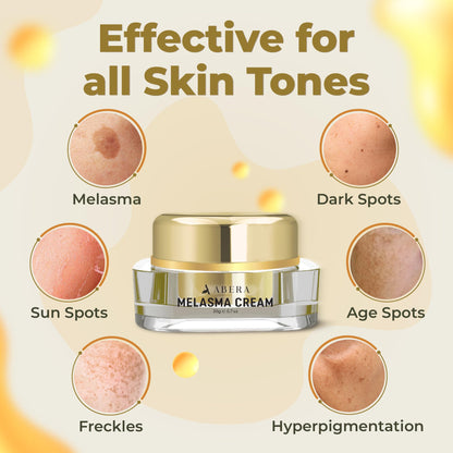 ABERA Melasma Cream - Dark Spot Corrector (0.7 oz) for Freckles, Sun Spots & Melasma