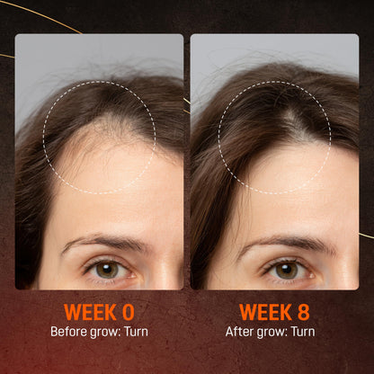 ABERA Hair Growth Serum – Natural Hair & Beard Support (Biotin & Castor Oil) | 1 Serum + Gift