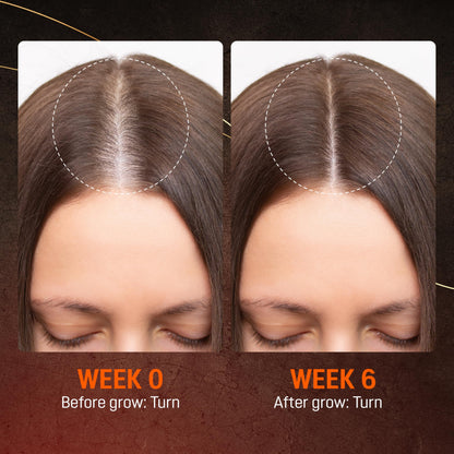ABERA Hair Growth Serum – Natural Hair & Beard Support (Biotin & Castor Oil) | 1 Serum + Gift