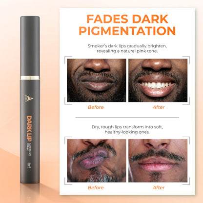 ABERA Dark Lips Corrector Cream – Lip Lightening & Moisturizing Plumper