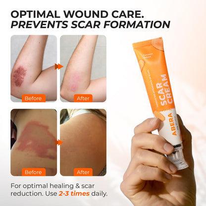 ABERA Scar Cream Upgrade – Skin Regeneration & Repair Cream for Wounds, Scratches & Irritated Skin (1.41 oz)