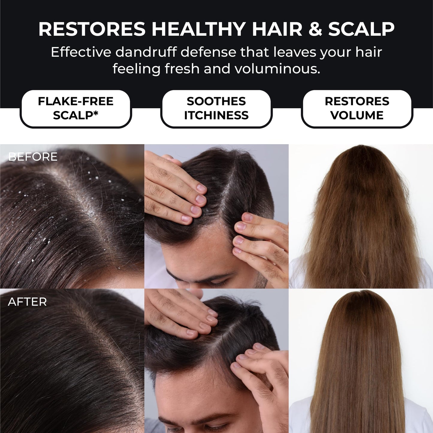 ABERA Anti-Dandruff Shampoo – 2-Pack for Stronger Hair & Healthier Scalp (6.67 fl oz each)