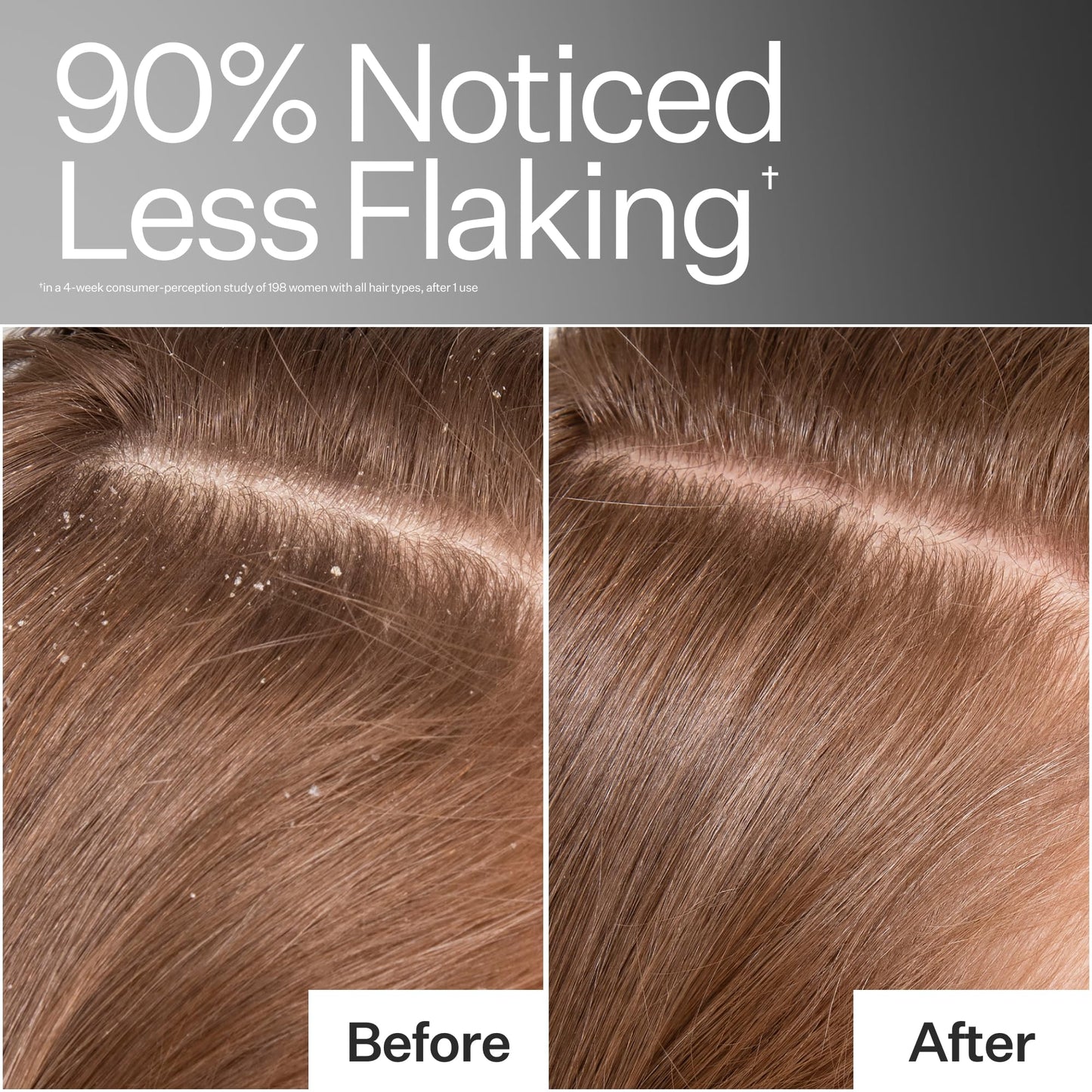 ACT+ ACRE Cold Processed Scalp Detox Oil — Sulfate-Free Scalp Care for Flaky, Dry & Itchy Scalp