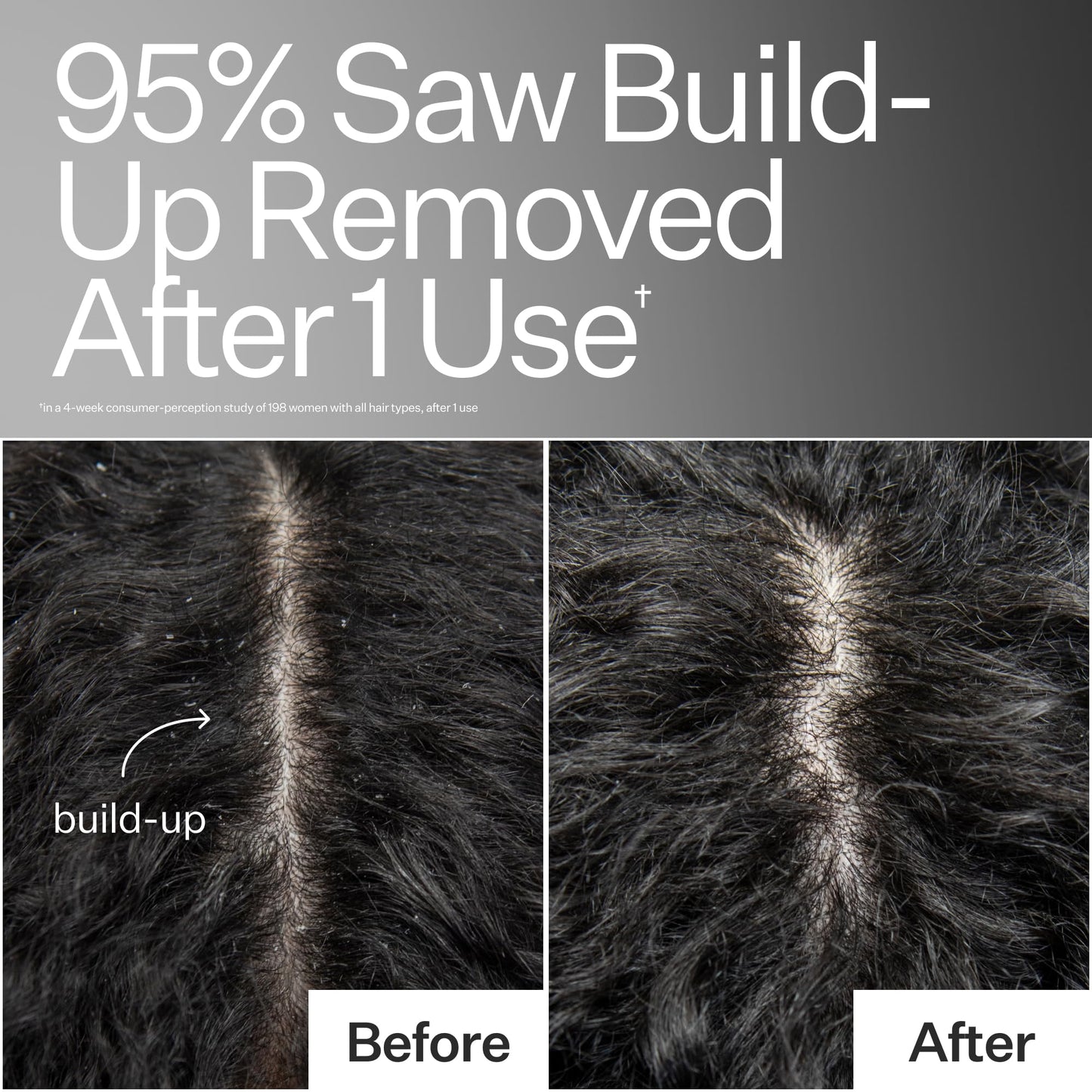 ACT+ ACRE Cold Processed Scalp Detox Oil — Sulfate-Free Scalp Care for Flaky, Dry & Itchy Scalp
