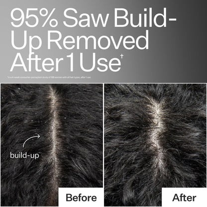ACT+ ACRE Cold Processed Scalp Detox Oil — Sulfate-Free Scalp Care for Flaky, Dry & Itchy Scalp
