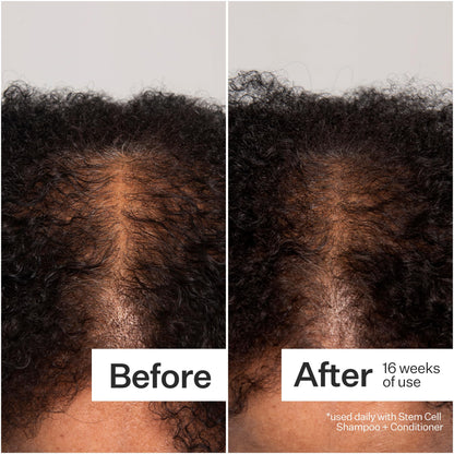 Act+Acre Cold Processed 3% Stem Cell Peptide Treatment – Boost Hair Density | Grape Stem Cells, Peptides + Caffeine | Vegan, Fragrance-Free | 3 fl oz
