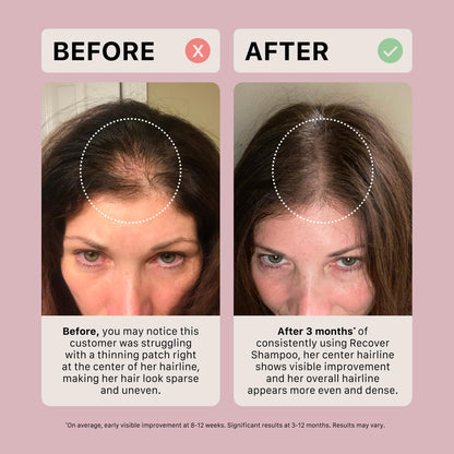 ACTIIV Ultimate Power Trio for Women – Fuller Hair, Scalp Care, Vegan & Color-Safe