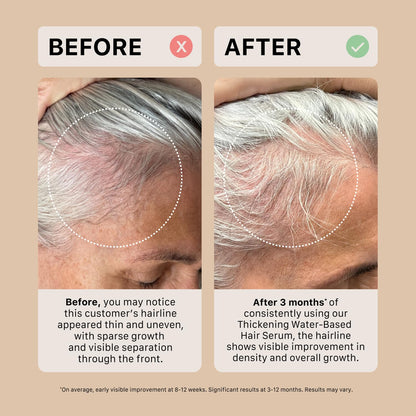 ACTIIV Ultimate Power Trio for Women – Fuller Hair, Scalp Care, Vegan & Color-Safe
