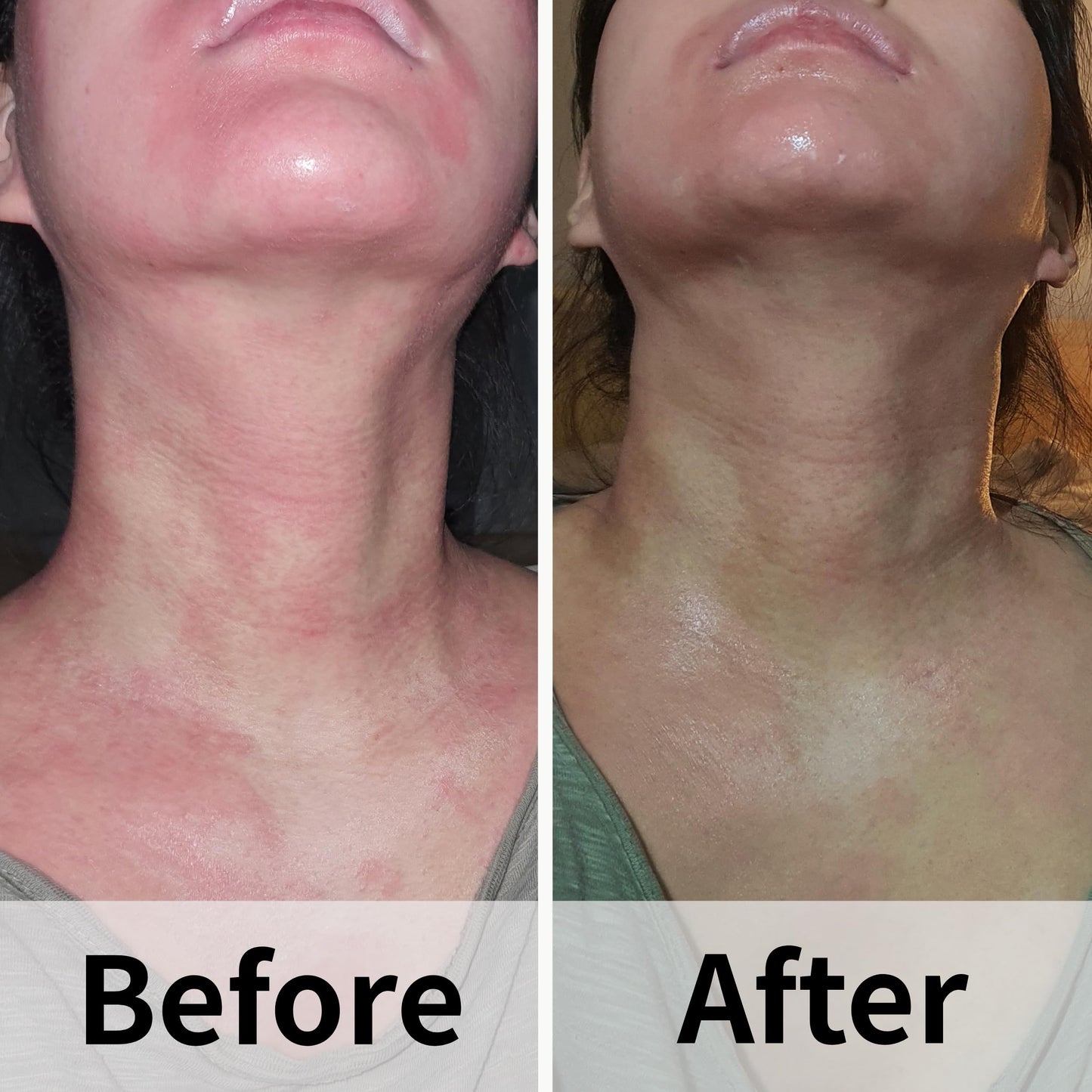 AD SOLUTION ATO Fast Calming Serum for Sensitive Skin | Itch Relief & Hydration