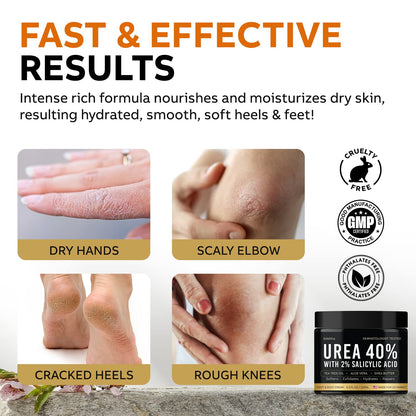 Adellina Urea Cream 40% – Maximum Strength Foot Repair & Hydration