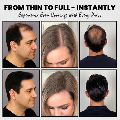 Adglamful Hair Fibers for Thinning Hair – Lightweight Building Fibers with Spray Applicator (Light Brown, 30g)