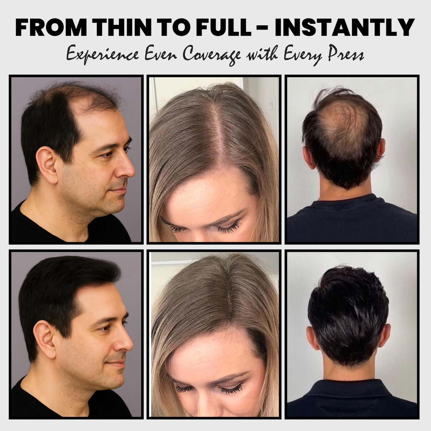Adglamful Hair Fibers for Thinning Hair – Spray Applicator, Long-Lasting Coverage (Grey, 30g)