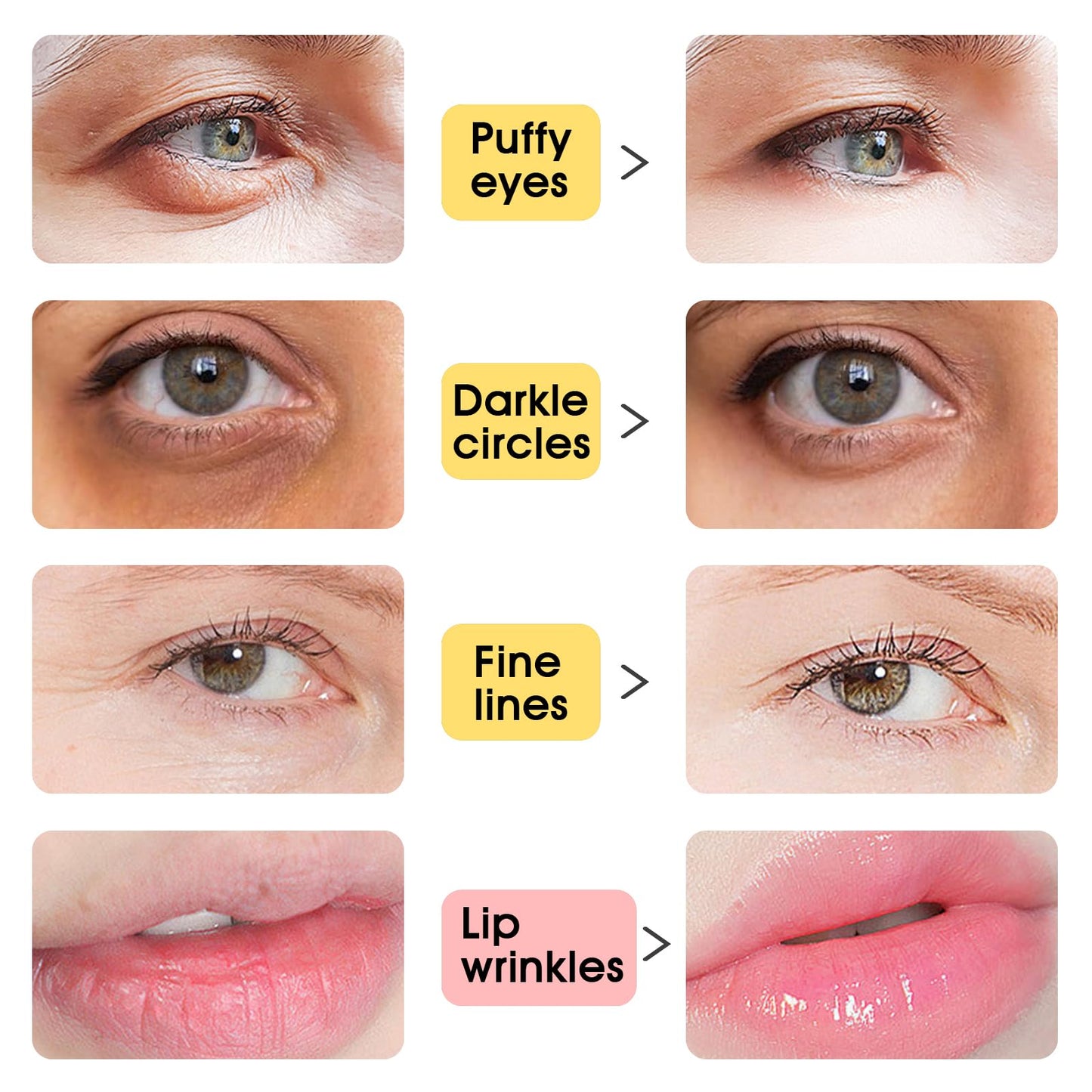 Adofect Collagen Lip & Eye Mask Set – Hydrating, Revitalizing (40 Pairs)