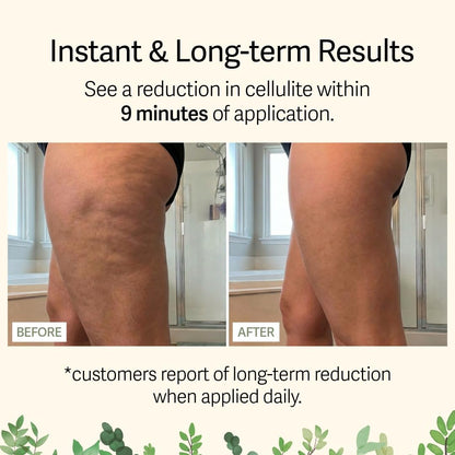 Adonia Organics LegTone – Organic Cellulite Cream for Firmer, Smoother Skin