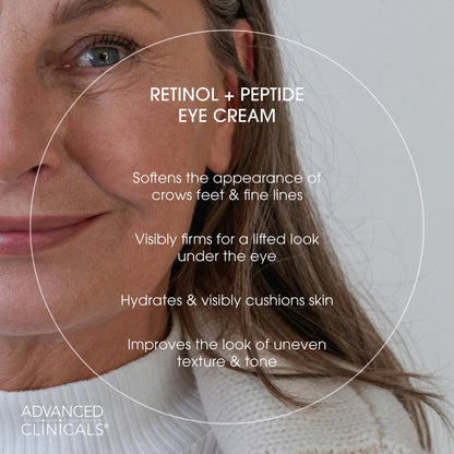 Advanced Clinicals Retinol Eye Balm + Peptides — Under-Eye Anti-Aging Cream, 1 Fl Oz