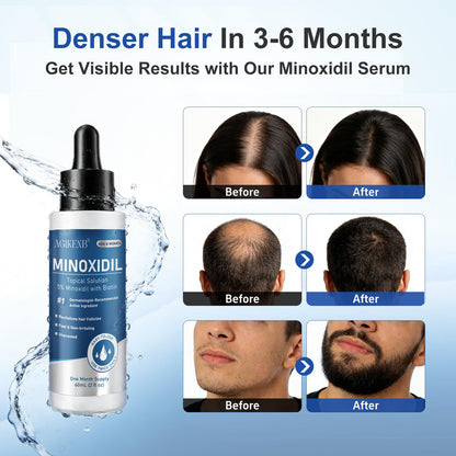 AGIKENB 8 Packs Topical 5% Minoxidil Serum – Hair & Beard Growth Support for Men & Women (Unscented, 8 x 2 fl oz)