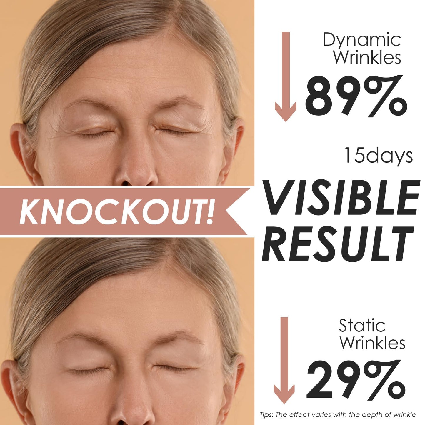 Akissos Forehead Wrinkle Patches Overnight – Deep Fascia Lift & 11-Line Coverage