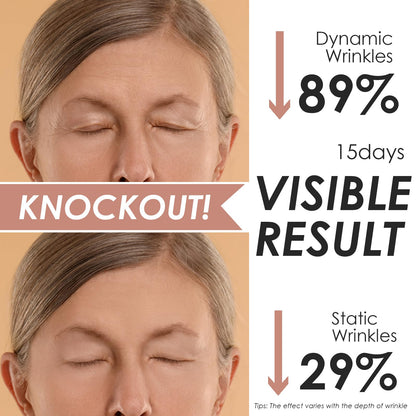 Akissos Forehead Wrinkle Patches Overnight – Deep Fascia Lift & 11-Line Coverage