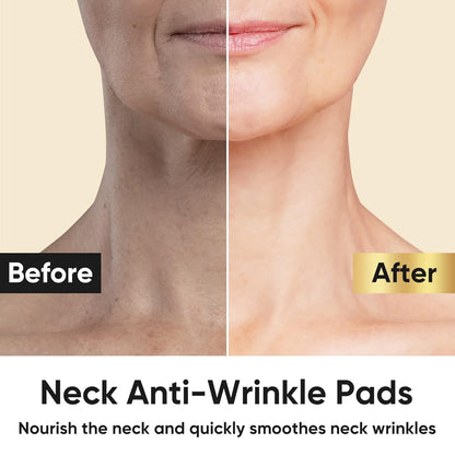 AKQBPN Neck Wrinkle Patches — 24K Gold Collagen Neck Pads for Firming & Hydration