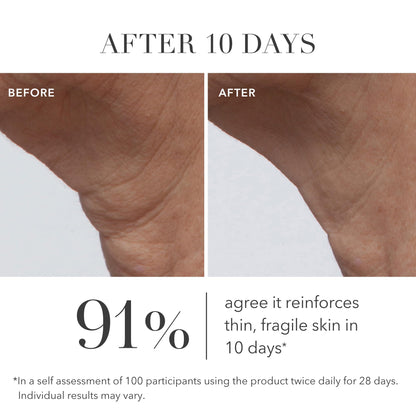 Algenist GENIUS Ultimate Anti-Aging Cream – Restore Elasticity, Smooth Fine Lines